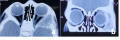 Thumbnail for version as of 12:54, June 1, 2021