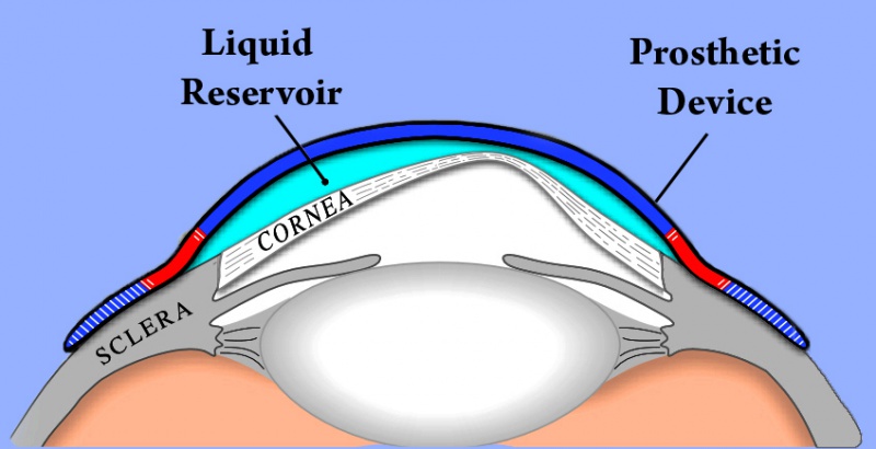 File:PROSE-Device---horizontal---5-9-2011-flattened.jpg
