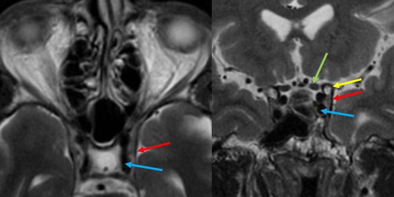 File:Figure 1 MRI.jpg