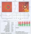 Thumbnail for version as of 14:57, July 7, 2010