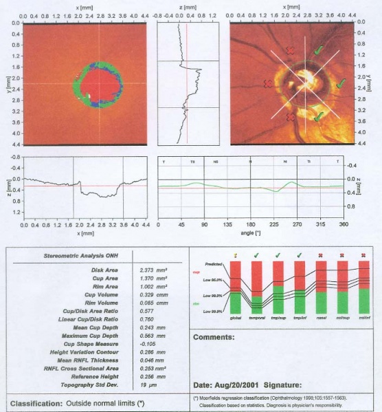 File:HRT.jpg