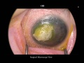 Thumbnail for version as of 11:02, April 12, 2012