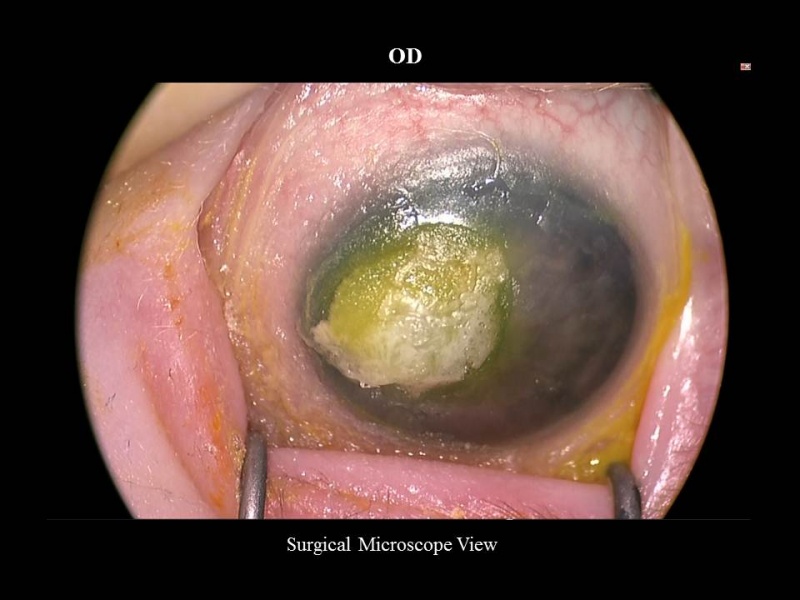 File:MHDSlide20.JPG