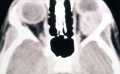 Thumbnail for version as of 19:57, June 1, 2011