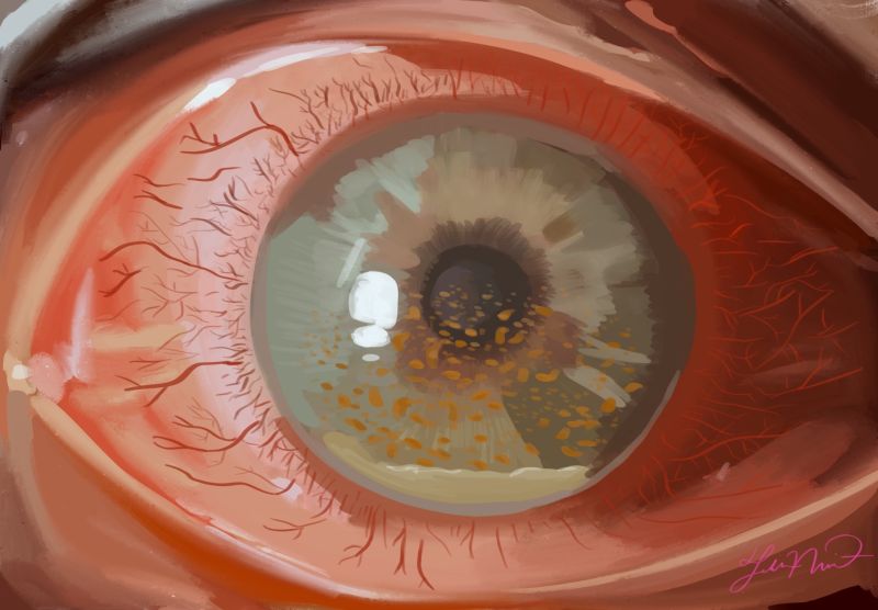 File:CMV AU.jpg