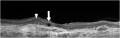Thumbnail for version as of 19:16, May 23, 2023