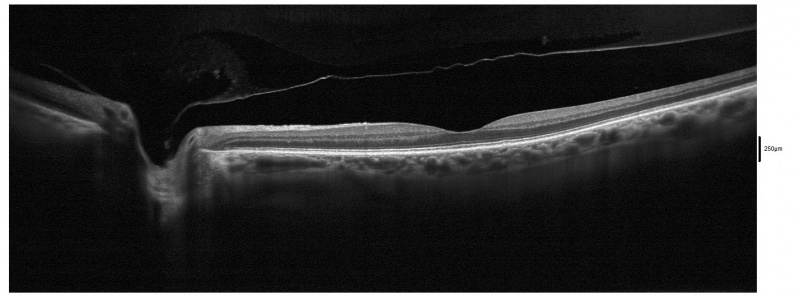 File:Dpv.jpg