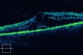 Thumbnail for version as of 09:39, May 23, 2010