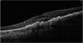 Thumbnail for version as of 19:18, May 23, 2023