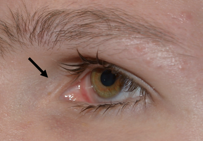 File:Enlarged fornices SBS.png