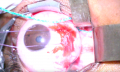 Thumbnail for version as of 18:16, November 22, 2021