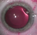 Thumbnail for version as of 11:14, February 23, 2011