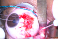 Thumbnail for version as of 18:43, November 22, 2021