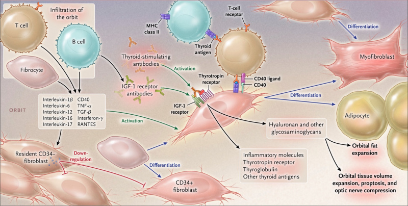 File:TED pathogenesis.jpeg