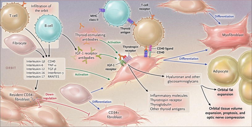 Teprotumumab - EyeWiki