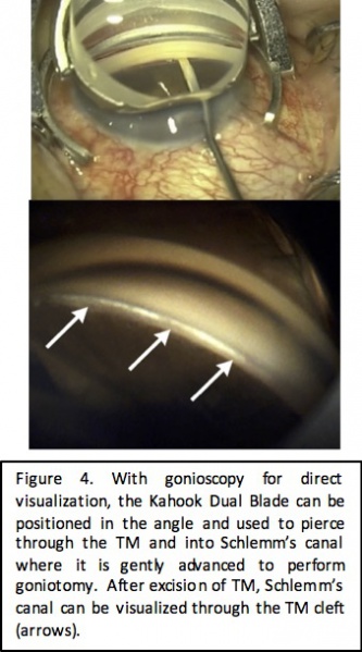 File:KDB fig 4.jpg
