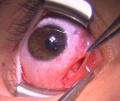 Thumbnail for version as of 12:08, June 28, 2010