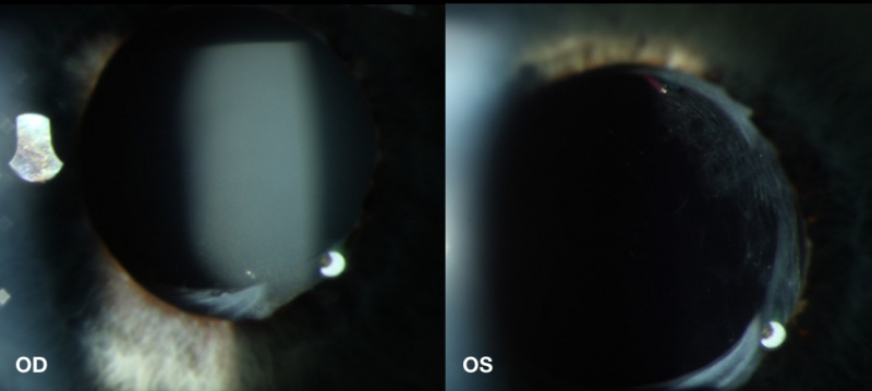 File:Slit Lamp CBDS.001.jpeg