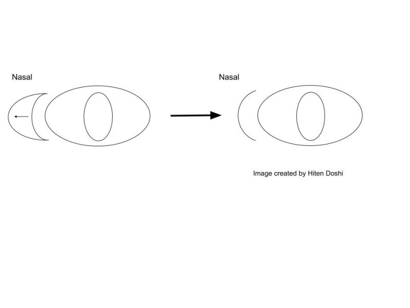 File:C to u flap.jpg