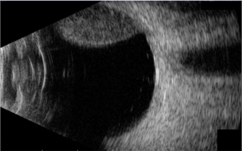 File:Figure 1. B scan.png