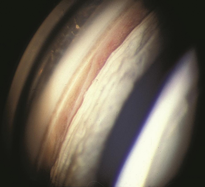 File:Kaufman 11.jpeg