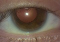 Thumbnail for version as of 13:18, August 13, 2011