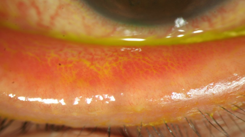 File:Ekc pic 7.jpg