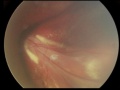 Thumbnail for version as of 13:46, November 19, 2016