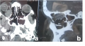 Thumbnail for version as of 04:39, June 1, 2021