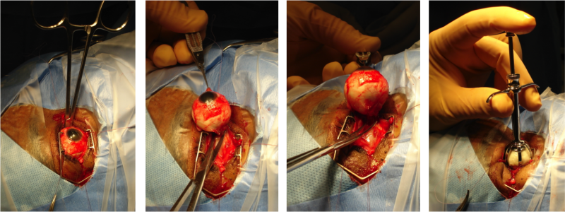 File:Enucleation Cutting Nerve.png