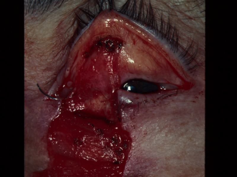 File:Hughes flap.png