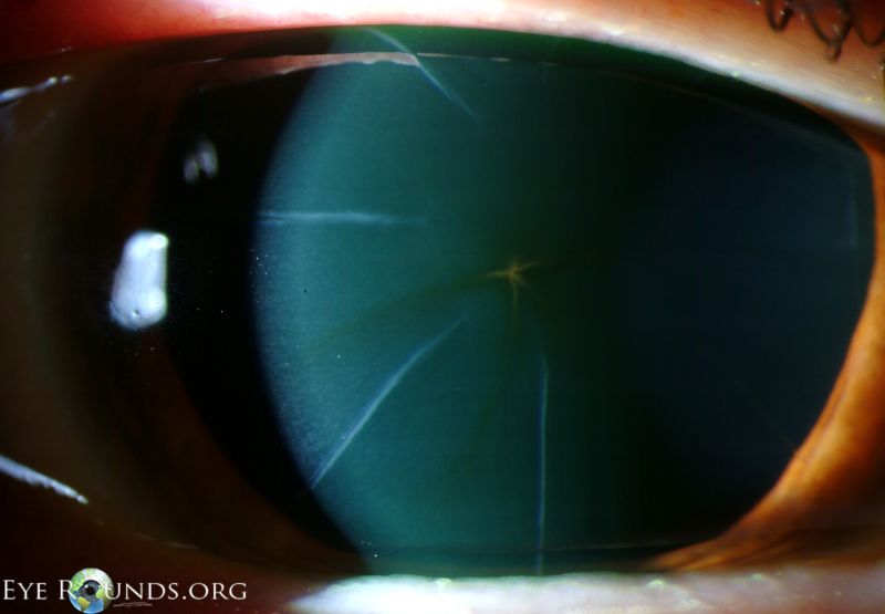 File:Stellate-iron-line-RK-LRG.jpg