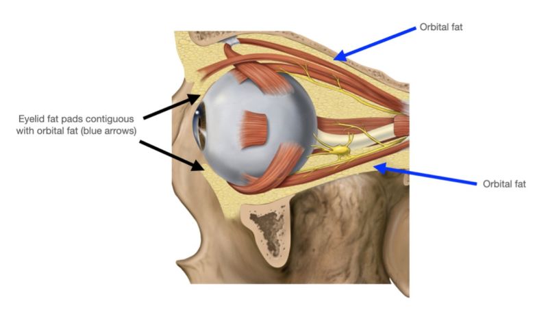 File:OASCside.jpg