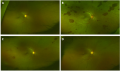 Thumbnail for version as of 09:18, September 1, 2022