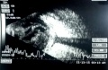 Thumbnail for version as of 09:05, June 1, 2017