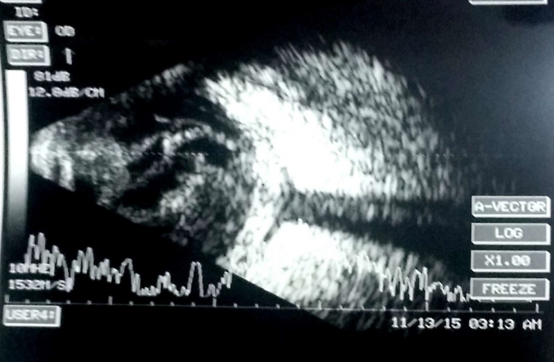 File:Koushik t sign endoph panoph.jpg