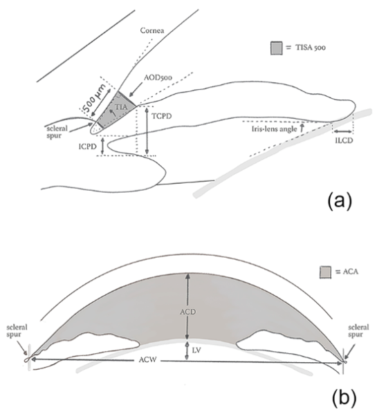File:Outflow Pathway Imaging Figure 1.png
