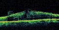 Thumbnail for version as of 05:38, May 31, 2024
