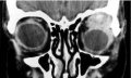 Thumbnail for version as of 20:35, January 5, 2012