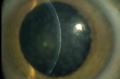 Thumbnail for version as of 15:51, June 28, 2019