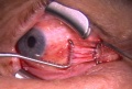 Thumbnail for version as of 13:27, June 29, 2010