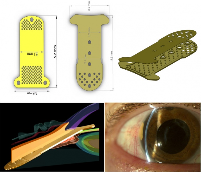 File:Gms combined images.jpg