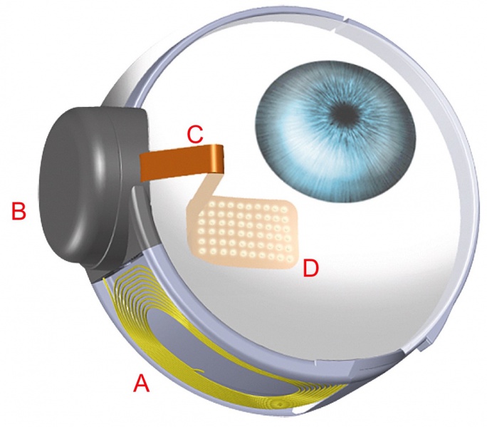 File:Argus2internal.jpg