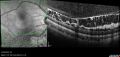 Thumbnail for version as of 10:04, January 14, 2023