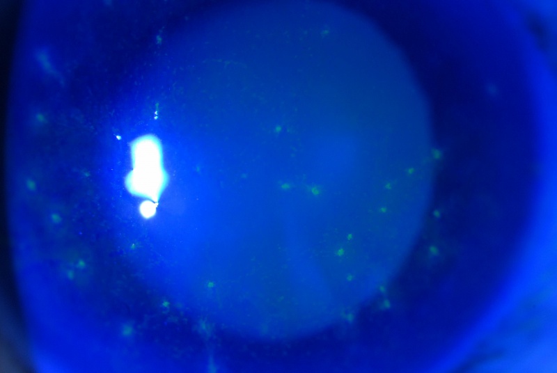 File:Thygeson 2.jpg