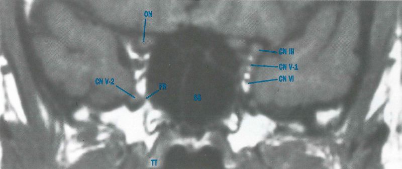 File:AA0 CVS labeled.jpg