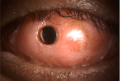 Thumbnail for version as of 14:38, March 22, 2022