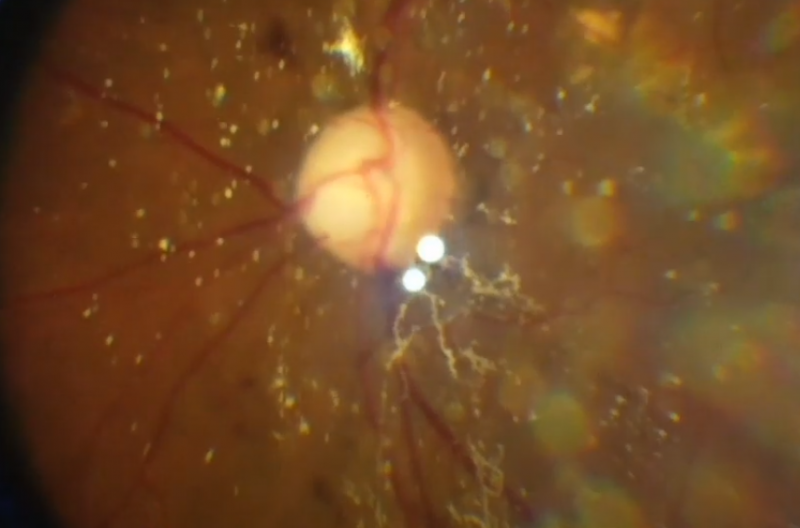 File:Synchysis Scintillans-Dr John Davis.png