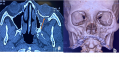 Thumbnail for version as of 20:48, June 1, 2021