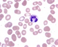 Thumbnail for version as of 00:25, December 1, 2013